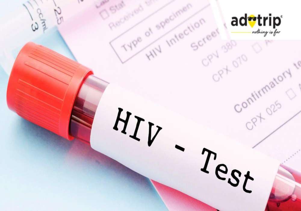 HIV test cost in india, HIV (human immunodeficiency viruses) test price in india